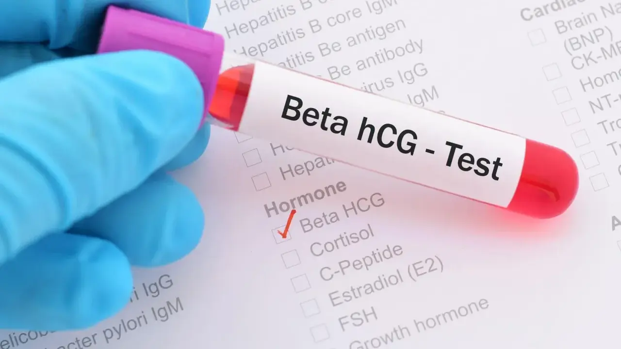 Provette con campione di sangue per test Beta hCG positivo. Il segno di spunta rosso indica il risultato.
