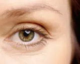Occhio con iride verde-marrone, ciglia lunghe e sopracciglia sottili, che suggeriscono alopecia sopracciglia.
