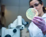 Ricerca scientifica collega alzheimer e problemi intestinali. Scienziata esamina coltura batterica in piastra Petri.