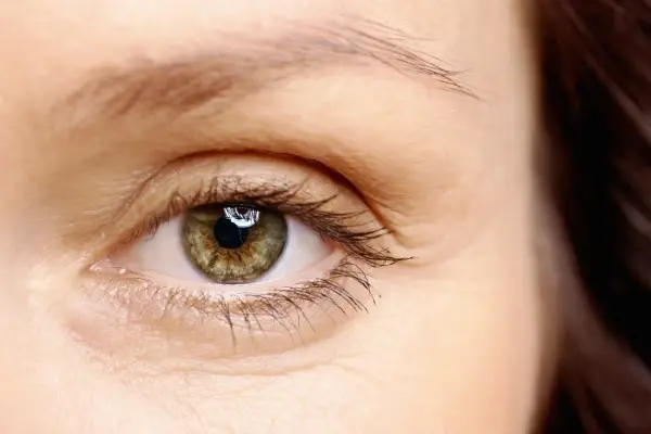 Occhio con iride verde-marrone, ciglia lunghe e sopracciglia sottili, che suggeriscono alopecia sopracciglia.