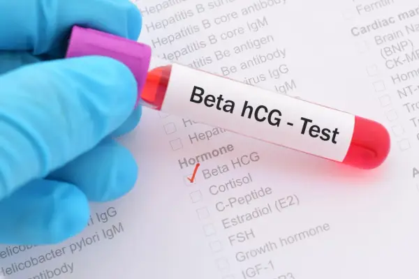 Provette con campione di sangue per test Beta hCG positivo. Il segno di spunta rosso indica il risultato.