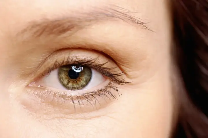 Occhio con iride verde-marrone, ciglia lunghe e sopracciglia sottili, che suggeriscono alopecia sopracciglia.
